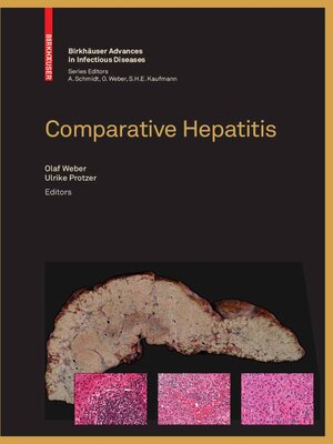 cover image of Comparative Hepatitis